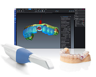 スキャン- デザイン- 3Dプリント スキャン- デザイン- 3Dプリント