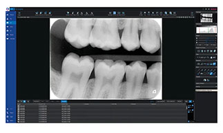 プランメカ Romexis® との連動