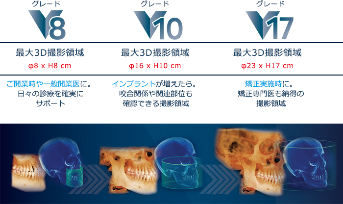 グレードは3タイプ。いつでもアップグレードが可能 グレードは3タイプ。いつでもアップグレードが可能