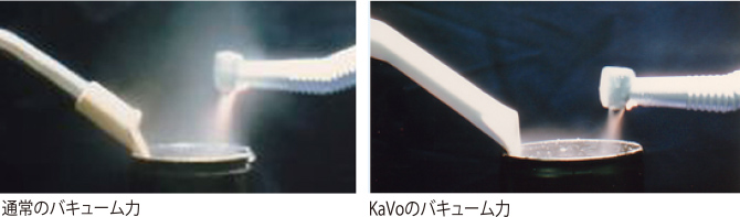 KaVo のバキュームによる吸引 KaVo のバキュームによる吸引