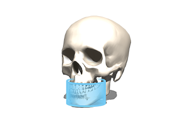 FOV Φ9 × H6cm