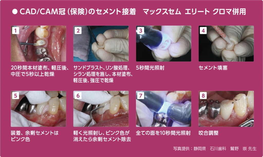 cad_cam_chroma | カボ プランメカ ジャパン株式会社 / KaVo Planmeca Japan K.K.